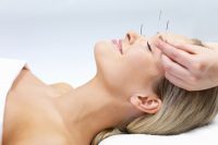 Acupuncture therapy - alternative medicine. Portrait of a beautiful woman in acupuncture therapy